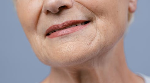 Fine Lines And Wrinkles Treatment Birmingham